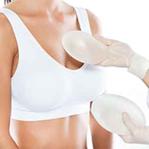 Aumento de mamas con prtesis Gonzlez-Fontana
